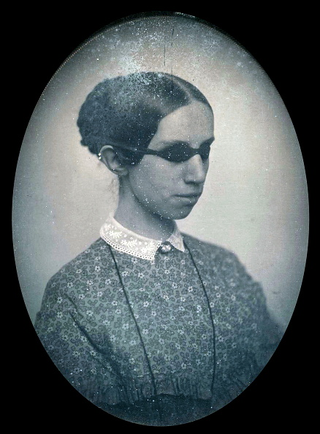 Laura Bridgman, 1855. Image via Getty.